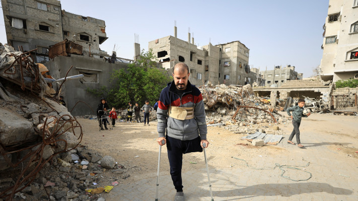 אדם שאיבד את רגלו הולך ברחובות עזה