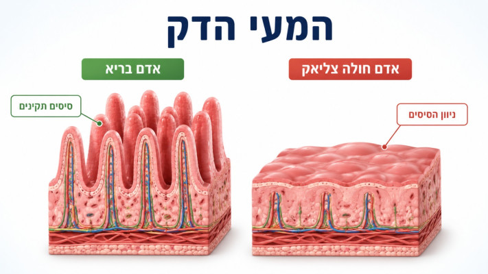 המעיים במחלת הצליאק. תסמינים רבים בעקבות החשיפה