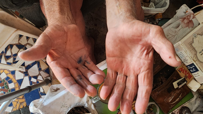 כפות ידיו של קחלון עדיין יוצרות, למרות הכאב הפיזי הניכר