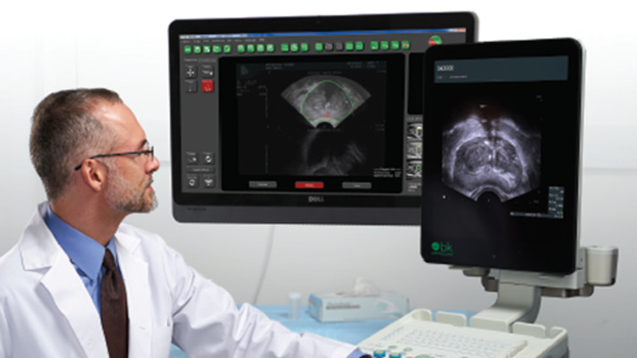 בדיקה מצילת חיים לגילוי סרטן הערמונית