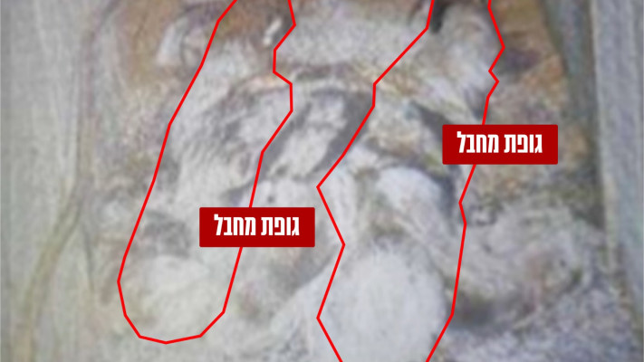 גופות מחבלים במנהרה שהתגלתה בסמוך לבית החולים הטורקי בעזה