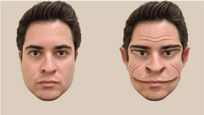 פרוסומטמורפופסיה