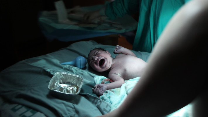 תינוק בחדר לידה (צילום: קובי גדעון, פלאש 90)