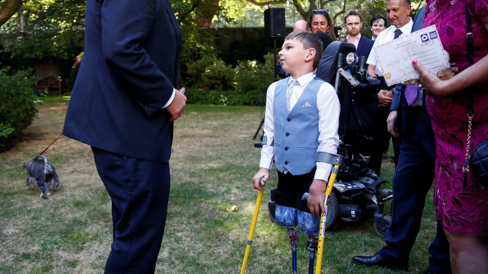 טוני, אמו התעללה בו כשהיה תינוק בן שישה שבועות וכתוצאה מכך הוא איבד את רגליו