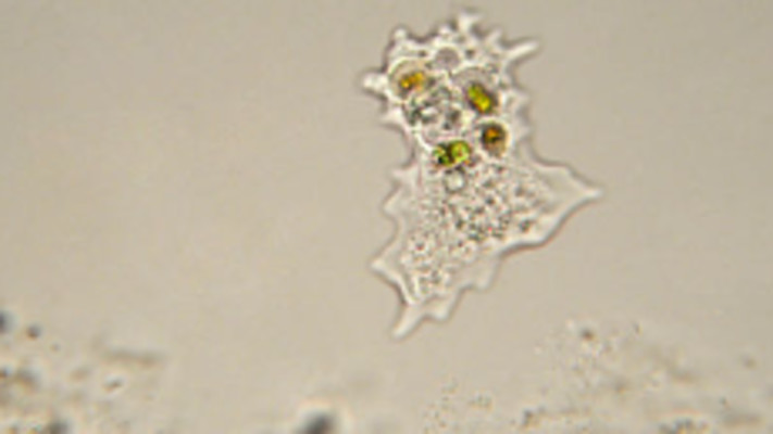 אמבה. חדירה&nbsp;דרך&nbsp;האף&nbsp;אל&nbsp;המוח