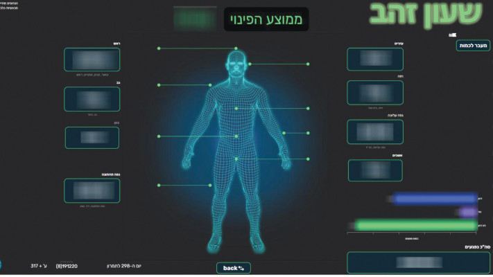 שעון זהב (צילום: דובר צהל)