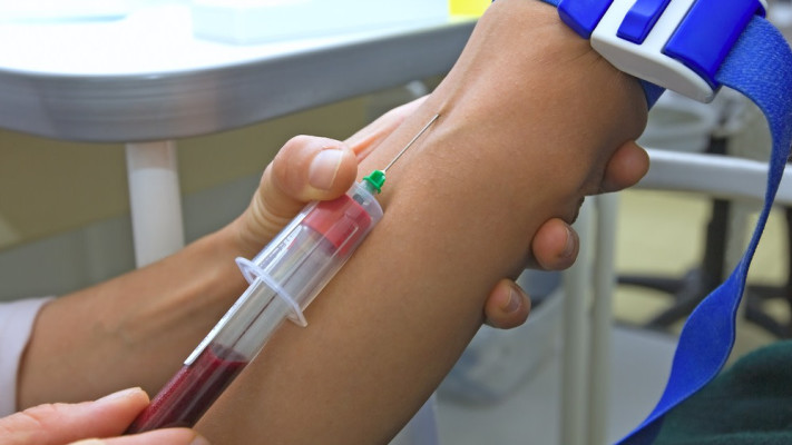 בדיקת דם ל-HIV. לאחר מגע מיני מזדמן לא מוגן 