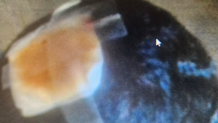 הקורבן לאחר התקיפה