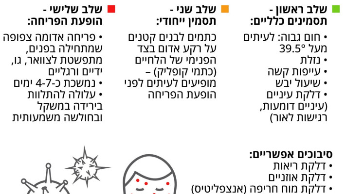 חצבת