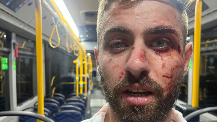 נהג אוטובוס שהותקף בירושלים (למצולם אין קשר לכתבה)