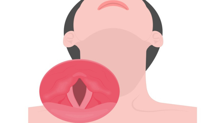 מיתרי הקול. הניתוח מביא לשינוי בתוך כמה חודשים (צילום: שאטרסטוק)