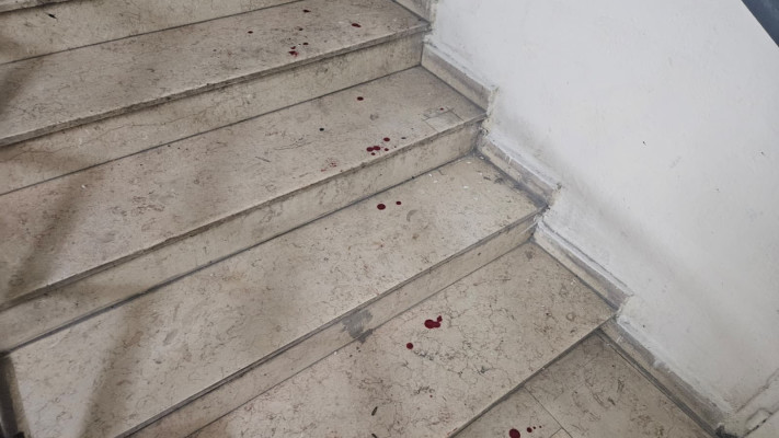 דם על מדרגות הבניין בתל אביב