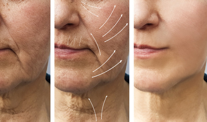 You have not heard of it yet: Dr. Maya Roseman’s solution for wrinkle prevention