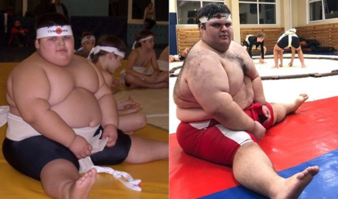 “The fattest kid in the world” passed away at the age of 21