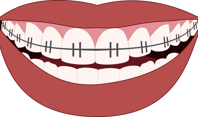 Orthodontics – all the ways and methods