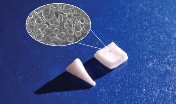 BioChange’s ReGum implant has been scientifically proven to heal receding gums
