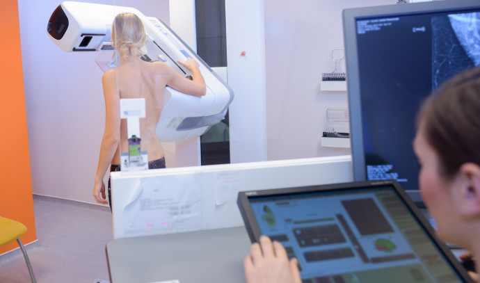 Why experts recommend early mammography for breast cancer detection