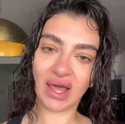פרידה עוזיאל על הפפילומה  (צילום: יחסי ציבור)