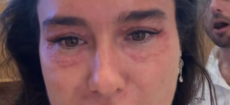 הסטורי של אדל בספלוב