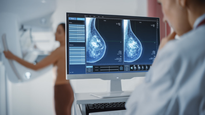 One mammogram, two diagnoses: AI identifies heart disease in women in a simple test