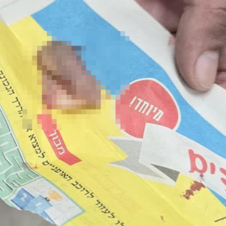 אוזנו של הקטין שהותקף בתא המעצר ברמלה