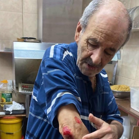 תיעוד הפציעה