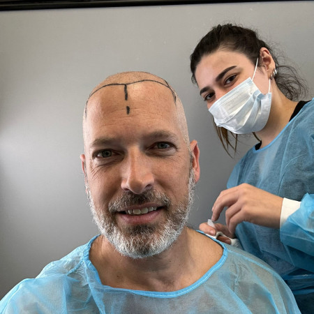 גיא שיקר בהליך השתלת השיער (צילום: פרטי)