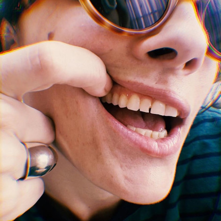 נגה ארז מציגה שן שבורה  (צילום: צילום מסך אינסטגרם)