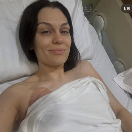 ג'סי ג'יי לאחר הניתוח שעברה (צילום: מתוך אינסטגרם)