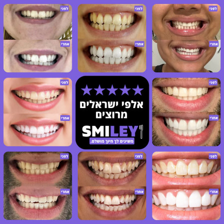 הפיתוח הישראלי שמלבין שיניים תוך כדי צחצוח – בלי לשנות כלום בשגרה! (צילום: יחצ)