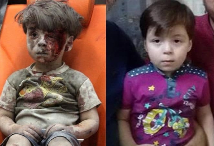 עומראן דקניש, הילד הסורי שנפצע בחלב, אז והיום (צילום:  צילום מסך 'טלגרף')