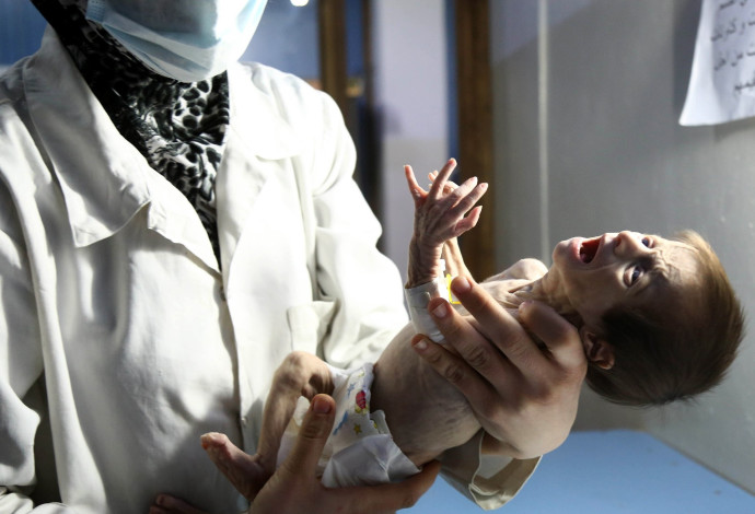 סאהר התינוקת הסורית (צילום:  Getty images)