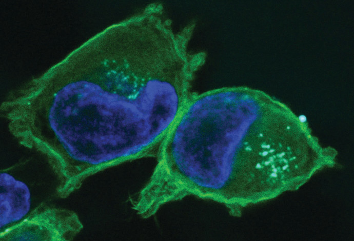תאים נגועים בסרטן הלבלב (צילום:  הדס גיבורי, אוניברסיטת תל אביב)
