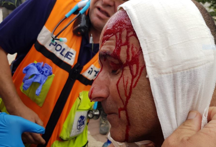 שוטר שנפצע במהלך הפגנה נגד פינוי נתיב האבות  (צילום:  דוברות המשטרה)