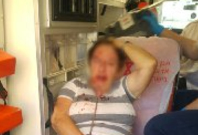 הקשישה שהותקפה בקריית גת (צילום:  דוברות המשטרה)