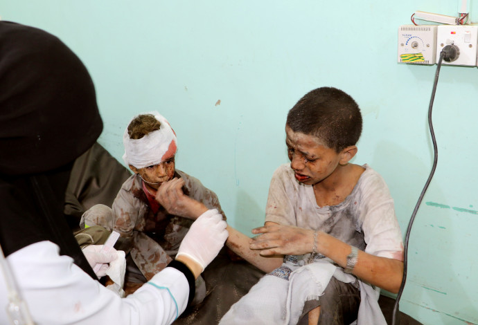 ילדים שנפגעו במתקפה הסעודית בתימן (צילום:  רויטרס)
