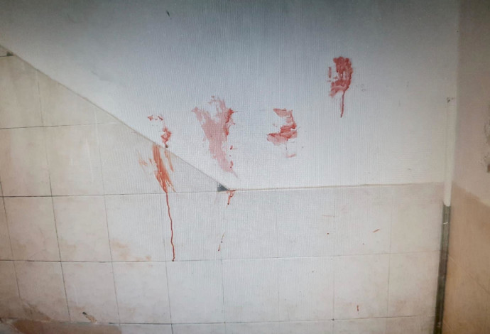 אישה הוכתה ונדקרה ע"י בן זוגה באשדוד (צילום:  דוברות המשטרה)
