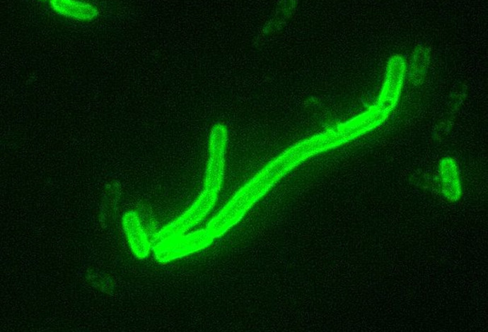 חיידק Yersinia pestis, הגורם למחלת הדבר (צילום:  CDC/ Courtesy of Larry Stauffer, Oregon State Public Health Laboratory)