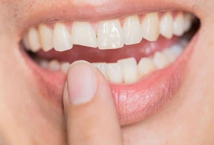 שיניים (צילום:  שאטרסטוק)