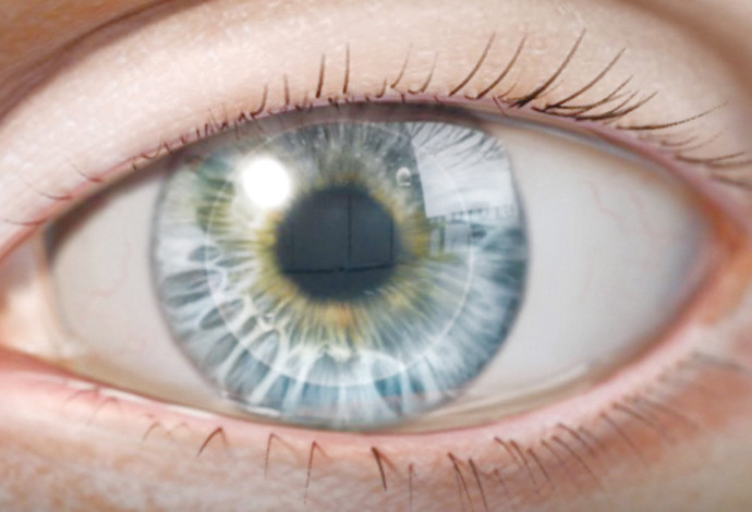 שתל מלאכותי לעין של חברת  EyeYon Medical  (צילום:  יחצ)
