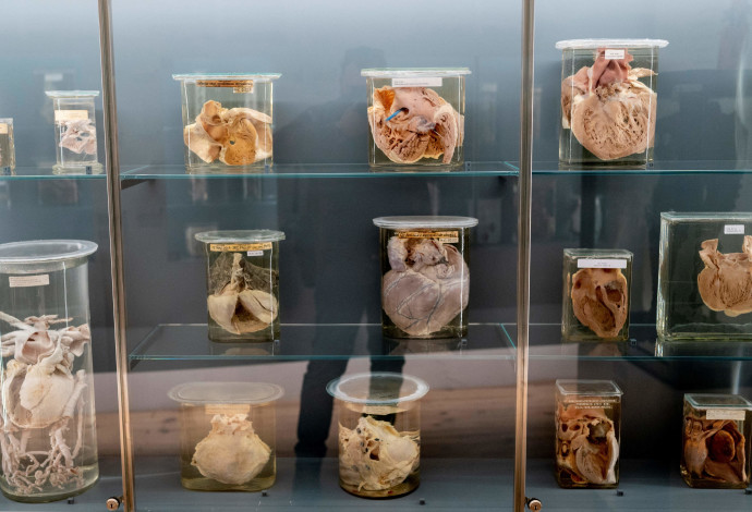 איברים משומרים בני 200 שנה מוצגים במוזיאון בווינה (צילום:  Getty images)