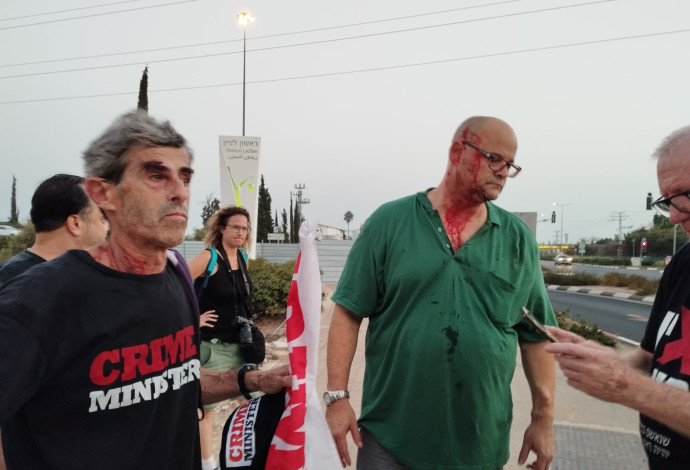 פעילי "קריים מיניסטר" שהותקפו ונפצעו (צילום:  ללא קרדיט)