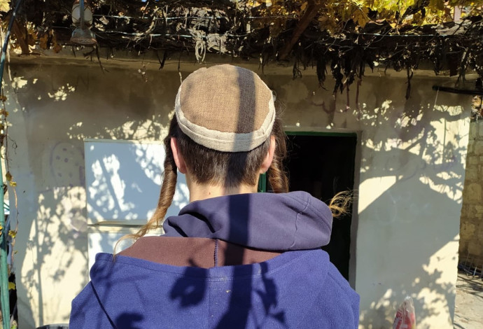 הצעיר שהותקף בירושלים, צילום פרטי (צילום:  באדיבות המצולם)