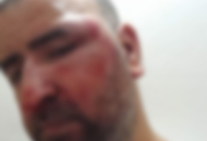 תושב באר שבע שנפגע בשוד האלים בביתו (צילום:  פרטי)