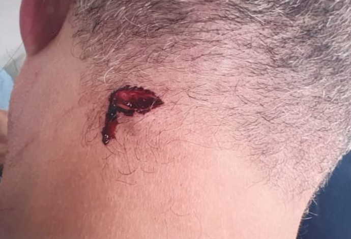 הותקף על רקע מחלוקת בנושא תשלום ועד הבית  (צילום:  משטרת ישראל)