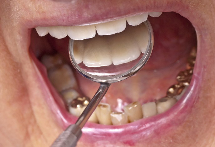 שיניים, אילוסטרציה (צילום:  אינג'אימג')