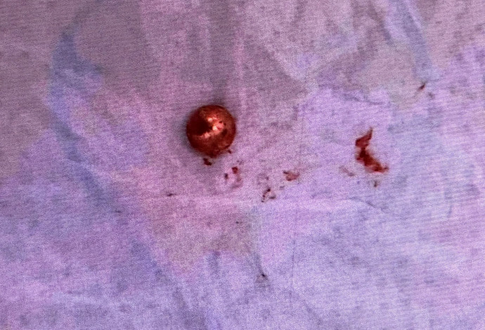 כדור המתכת שחדר לידו של הקורבן (צילום:  דוברות המשטרה)