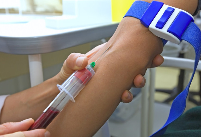 בדיקת דם ל-HIV. לאחר מגע מיני מזדמן לא מוגן  (צילום:  שאטרסטוק)