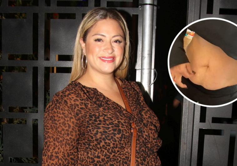 Leah Griner reveals the excess fat – just before the tummy tuck surgery