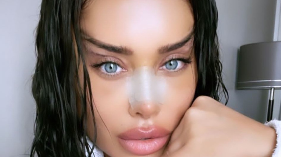 השינוי של אביבית בר זוהר (צילום: צילום מסך אינסטגרם)